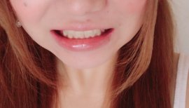 歯ツルンツルン♪