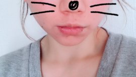 ダウンタイムー。。