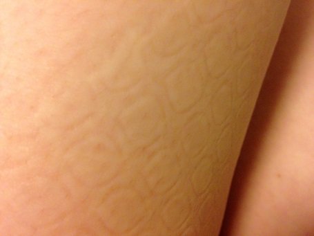 蓮コラじゃありません