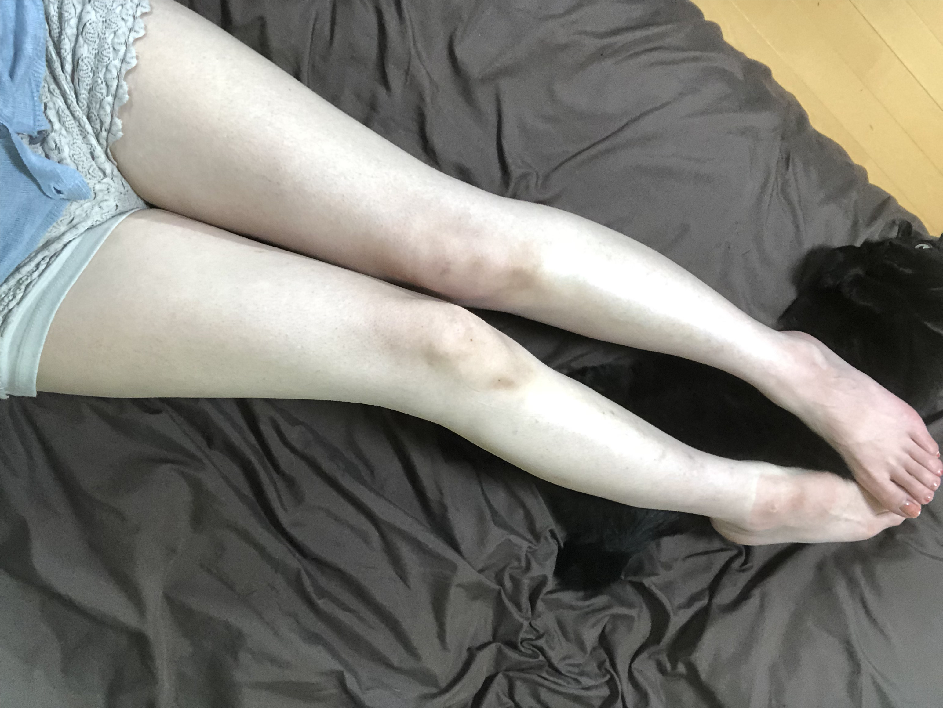 生脚正面で、、