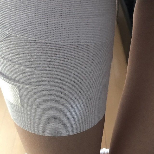 例の術後でございます。