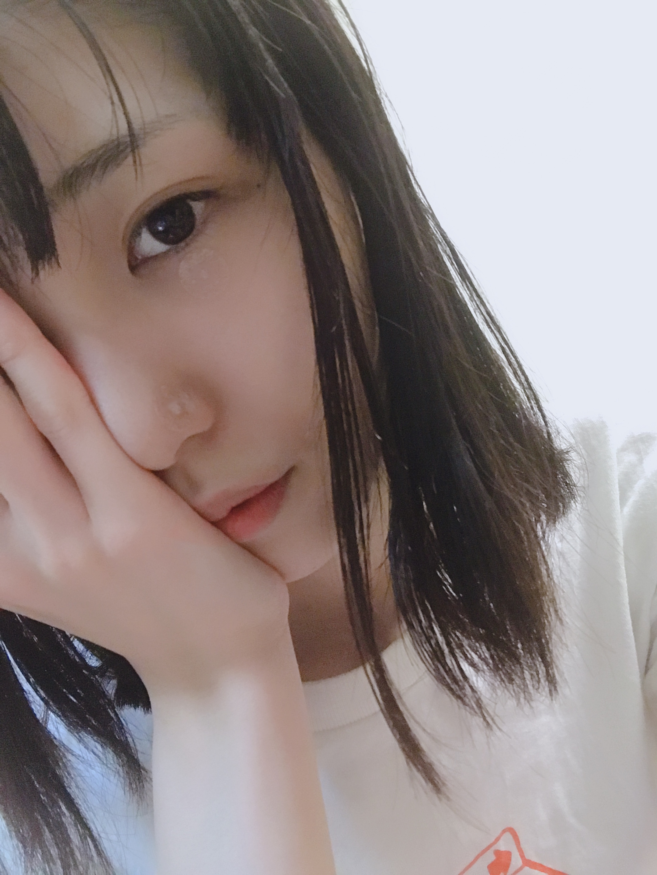 美容鍼