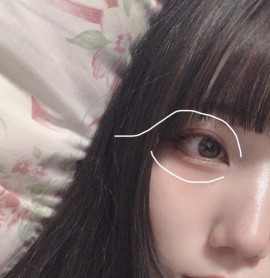 もうすぐ歯列矯正