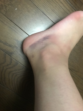 踏んだり蹴ったり(´；ω；｀)