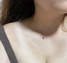 日焼けがすごいー?