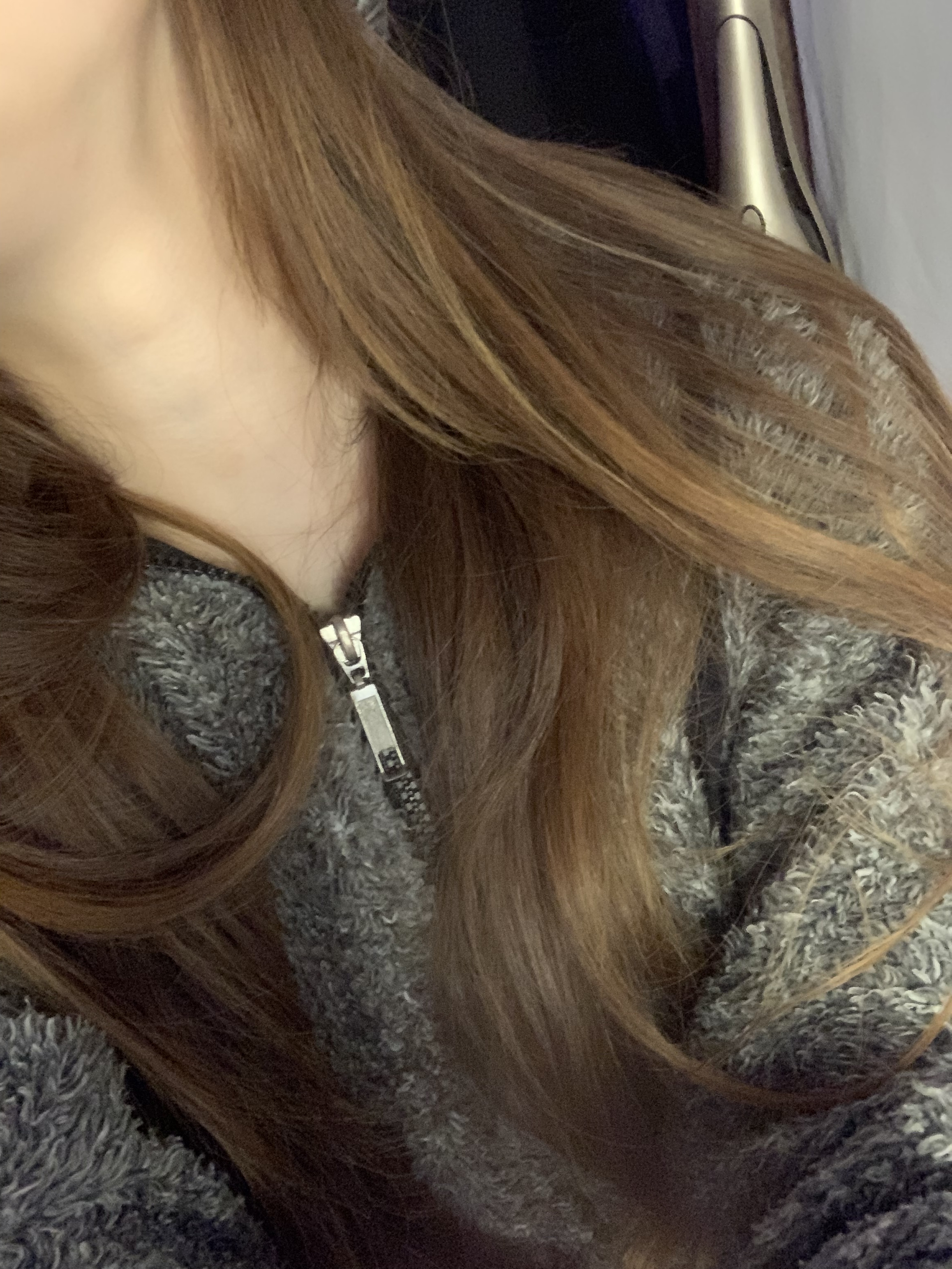 【悲報】腫れまくりまして…