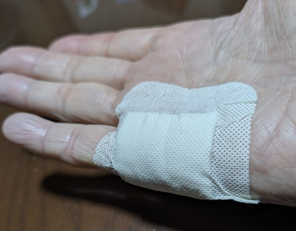 仕事でケガしちゃった(-_-;)