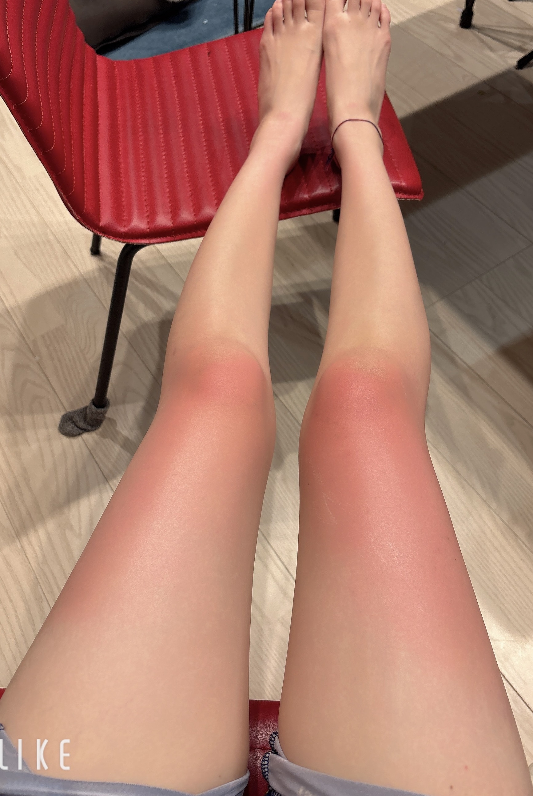 日焼けしちゃったよー?